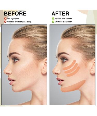 4 Rolls Face Lift Tape - Overnight Wrinkle Reduction Patches for Forehead Face & Neck | 2.5cm x 5m | Global Shipping Available - Buy Online on GoSupps.com