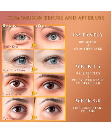 Saimyo 24K GOLD Eye Mask 60 Pcs - Amino Acid & Collagen Under Eye Mask for Dark Circles, Puffiness, Face Care - Beauty & Personal Care - Buy Online on GoSupps.com