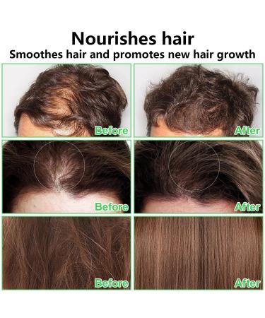 100% Raw Batana Oil for Hair Growth | Dr. Sebi Pure Organic Oil from Honduras | Anti Hair Loss & Split Ends | 4.2 FL oz - Buy Online on GoSupps.com