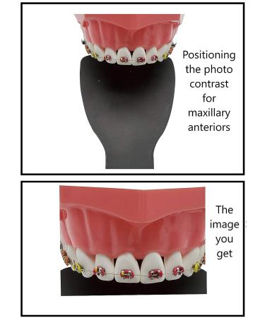 ARTMAN Photographic Black Contraster 6pcs Cassette Autoclavable Cheek Retractors - Dental Orthodontic Oral Photography Backdrop - Buy Online on GoSupps.com