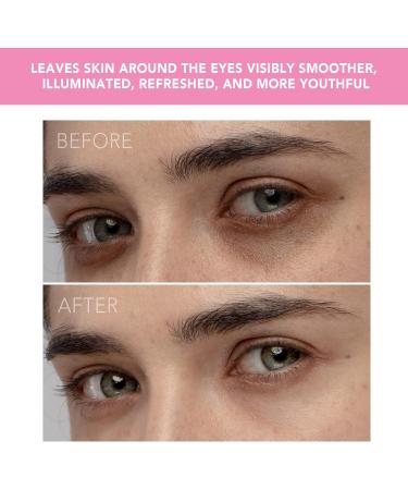 Foreo Iris Illuminating Eye Massager - Reduce Puffy Eyes, Dark Circles & Eye Bags | Enhances Eye Cream Absorption | Silicone | Anti-Aging | Petal Pink - Buy Online on GoSupps.com