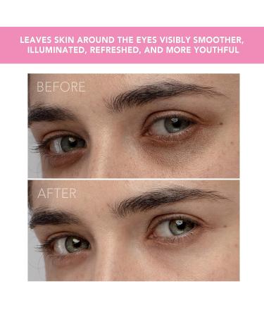 FOREO IRIS Eye Massager: Dark Circle & Eyebag Remover | Anti-Aging, Depuffer | Increases Eye Mask Absorption | Waterproof, Petal Pink - Buy Online on GoSupps.com
