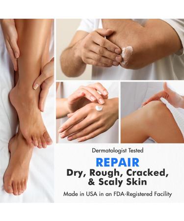 Urea Cream 40 with Salicylic Acid 4.6 Oz - Intensive Callus Remover for Dry Cracked Feet & Hands - Moisturizing & Exfoliating Foot Cream - 4.6 Ounce (Pack of 1) - Buy Online on GoSupps.com