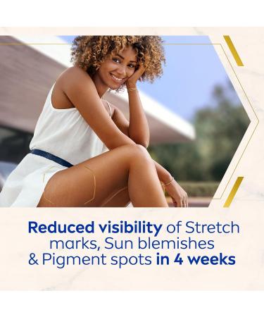 NIVEA Luminous 630 Anti Stretch Marks & Dark Spots Body Cream (200ml) 48-Hour Moisturising Cream Reduces Stretch Marks Sun Blemishes and Pigment Spots Body Lotion - Buy Online on GoSupps.com
