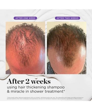 Dr. Groot Miracle in Shower Treatment | Korean Hair Care | 5 Seconds to Smooth Hair with Rosemary Oil | Moisturizing Scalp & Hair Rinse | K-beauty Revitalizing Solution - Buy Online on GoSupps.com