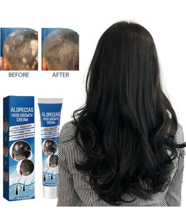 Alopecia Cr me de croissance des cheveux p te capillaire naturelle cr me paississante des cheveux formule naturelle pratique compacte 20 g pour homme et femme adulte - Buy Online on GoSupps.com