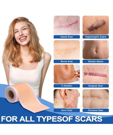 Buy Silicone Scar Sheets & Tape for Keloids C-Section Surgery & Acne - Reusable & Effective Treatment - Buy Online on GoSupps.com