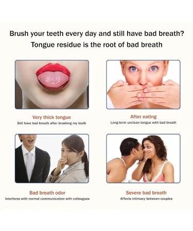 Zlongron U-Shaped Stainless Steel Tongue Scraper - Bad Breath Eliminator & Easy Clean Oral Care Tool with Case - Buy Online on GoSupps.com