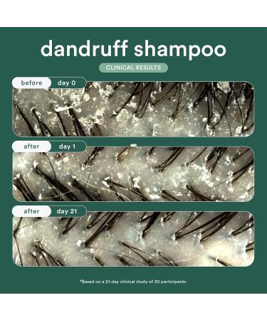 VERB Dandruff Shampoo - Magnolia & Eucalyptus 8 Fl Oz | Best Anti-Dandruff Solution for Healthy Scalp | International Shipping Available - Buy Online on GoSupps.com