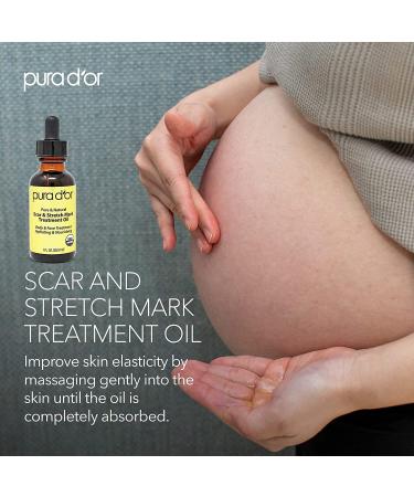 PURA DOR Organic Scar & Stretch Mark Treatment Oil | 1oz For Skin - Rosehip, Wheat Germ, Argan, Tamanu, Carrot, Rosemary, Lavender, Geranium, Patchouli, Sage - Buy Online on GoSupps.com