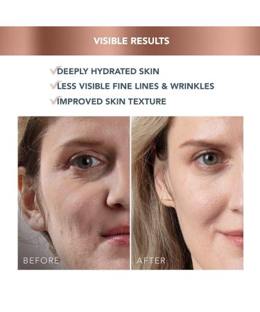 FOREO Supercharged HA+PGA Face Moisturizer - Vegan Wrinkle Cream with Hyaluronic Acid & Squalane - Clean Skincare - 1.6 fl. oz - International Shipping Available - Buy Online on GoSupps.com