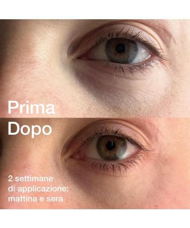 Origo Skincare Eye and Lip Contour Regenerating and Anti-Aging Action with Monastrell Extract and Hyaluronic Acid Reduces Dark Circles and Puffiness 30 ml - Buy Online on GoSupps.com