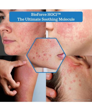 BioForce HOCl Pure Hypochlorous Acid Spray Refill for Face & Body (33 Oz) - Acne-Prone Skin & Eczema Piercing aftercare Made in Canada Gentle Skin Cleanser & Toner pH Balanced Non-comedogenic 33.8 Fl Oz (Pack of 1) - Buy Online on GoSupps.com