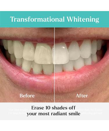 GLO Science So Brilliant Tooth Whitener Set Fast Sensitivity Free Teeth Whitening Technology Includes Warming Mouthpiece with LED Light 6% Hydrogen Peroxide Gel Pods Lip Balm & Travel Case - Buy Online on GoSupps.com