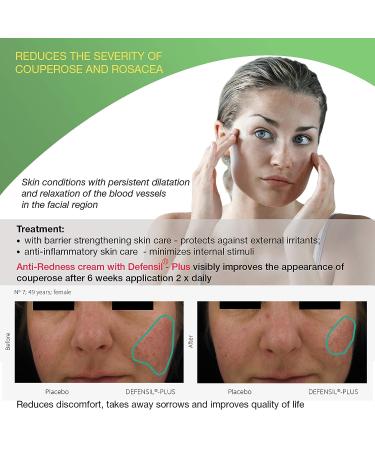 Redness Relief Face Eczema Cream - All-Natural Anti-Itch Treatment for Rosacea & Eczema - Hormone-Free Moisturizer for Facial & Body Care - Buy Online on GoSupps.com