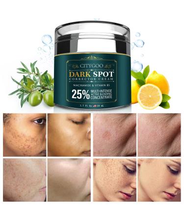 Dark Spot Remover for Face Dark Spot Corrector Cream Hyperpigmentation Melasma Freckle Sun Spots Removal for All Skin Types Dark Spot Corrector for Men and Women-1.7 fl oz