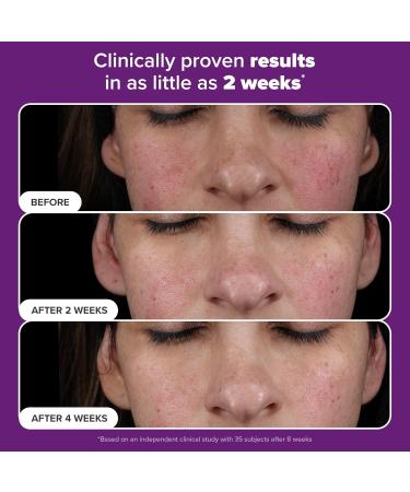 Paula s Choice Pro Retinaldehyde Dual-Retinoid Face Serum Advanced Treatment High Potency Anti-Aging Serum for Face Breakout-Prone Skin Radiance & Rough Bumpy Texture Fragrance-Free Full Size - 1 Fl Oz - Buy Online on GoSupps.com