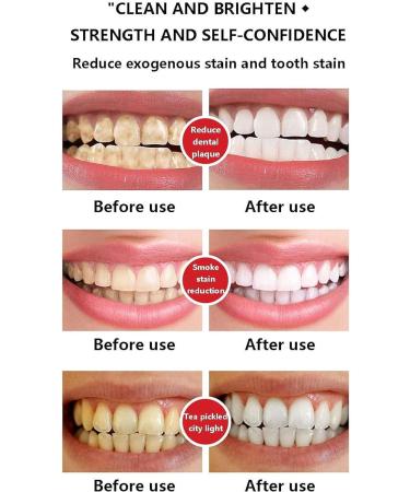 Sp-Y6 Probiotic Toothpaste 3 Day Whitening Aromatic Toothpaste Brightening and Stain Removal Toothpaste Toothpaste for Fresh Breath - Buy Online on GoSupps.com