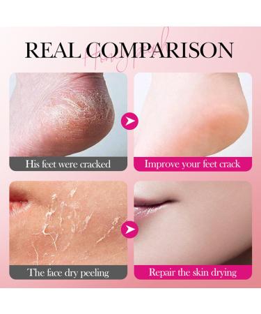 MrCuvaryas Urea 60 foot cream stick foot care cream hand cream body lotion with acid aloe vera cream for cracked heels and dry skin foot care - Buy Online on GoSupps.com