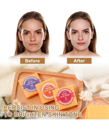 Buy Kojic Acid Soap - Dark Spot Remover & Turmeric Soap Bar (6 Pack) | Vitamin C Hyaluronic Acid Even Tone Skin - Buy Online on GoSupps.com