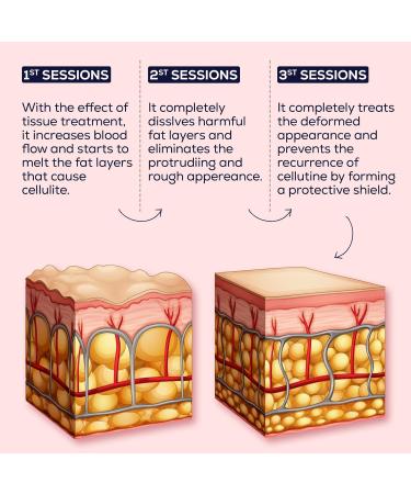 LAPULITA Anti Cellulite Spray - Natural Formula for Firming Legs, Hips, and Buttocks | Reduces Cellulite, Stretch Marks, and Saggy Skin - Buy Online on GoSupps.com