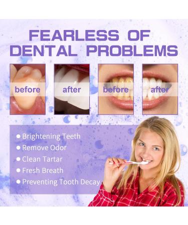 Powerful Teeth Whitening Toothpaste - Gentle Daily Care Deep Clean Odor Elimination & Stain Removal(2PCS) 1 Count (Pack of 1) - Buy Online on GoSupps.com