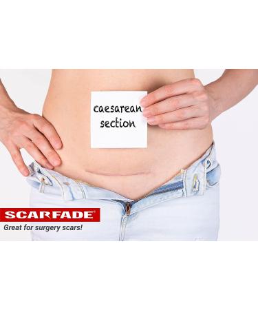 Vitamin C Scar Cream for Face & Body - 0.5 oz | Fade Scars & Blemishes - Buy Online on GoSupps.com