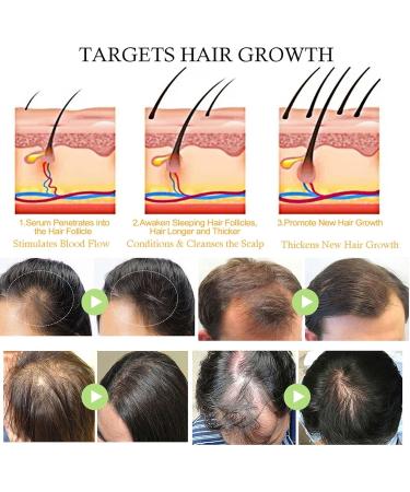  Lxitian Natural Hair Growth Oil 100% Natural Hair Oils with Green Coffee Coconut Oil Castor Oil Argan Oil and Rosemary Oil to Encourage Thickening - Buy Online on GoSupps.com