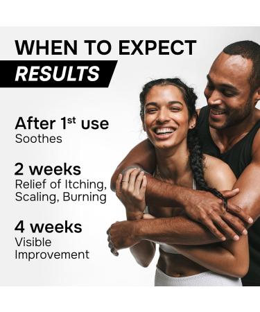 SimplyVital Antifungal Cream 1%, Made in USA - Fast Acting Relief for Jock Itch, Ringworm & Athlete's Foot - 2 oz - Buy Online on GoSupps.com