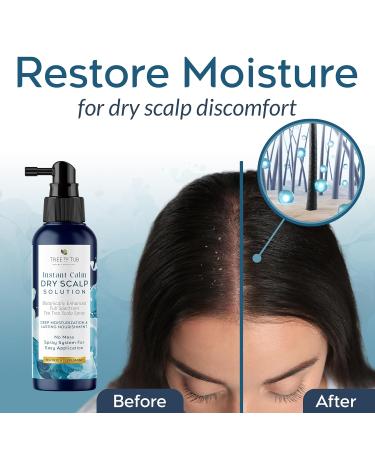 Tree To Tub Full Spectrum Scalp Spray - Intensive Moisturizer for Dry & Flaky Scalps | Tea Tree Oil Solution | International Shipping Available - Buy Online on GoSupps.com