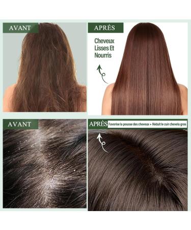 Rosemary Shampoo and Conditioner Set Rosemary Hair Growth Oil with Biotin and Mint Organic Rosemary Anti-Hair Loss Shampoo and Conditioner Scalp Care 200ml*2+30ml - Buy Online on GoSupps.com