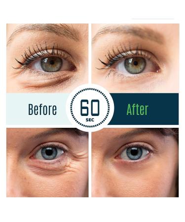 DERMAXGEN Puffy Eye Treatment - Instant Anti-Aging Eye Cream for Under-Eye Bags, Wrinkles, Dark Circles - 8ml - Buy Online on GoSupps.com