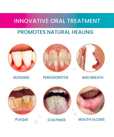 OROXID Forte Mouth Spray - Intensive Oral Care for Gingivitis 100 ml | International Shipping Available - Buy Online on GoSupps.com