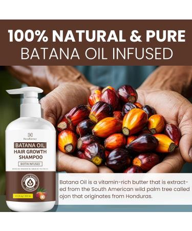 Batana Oil Hair Growth Shampoo - Natural Solution for Thinning Hair | Daily Hair Care for Women & Men - 10.1 fl. oz - Buy Online on GoSupps.com