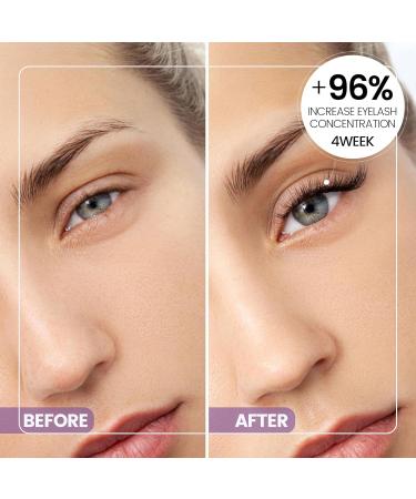 Eyelash Growth Serum | Natural Lash Serum for Thick Strong Lashes in 4 Weeks | 5ML (6 Months Supply - Buy Online on GoSupps.com