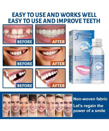 Temporary Tooth Filling Repair Kit - DIY Dental Repair Granules for Broken Teeth - Buy Online on GoSupps.com