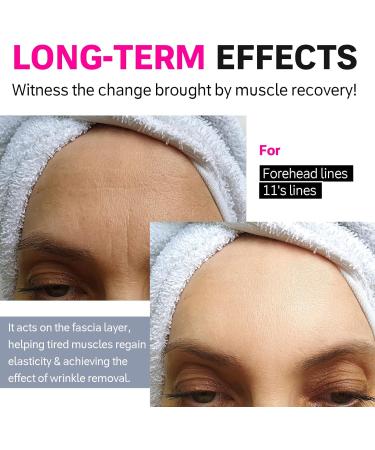 Akissos Pre Cut Forehead Wrinkles Patches 11 Lines Face Tape Elastic Strong Adhesion - Buy Online on GoSupps.com