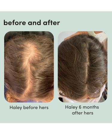 Hers Thick Fix Shampoo Conditioner & Minoxidil Set for Women - Hair Loss Treatment with Foam 5% Minoxidil - Color Safe Hair Thickening - 3 Count - Buy Online on GoSupps.com