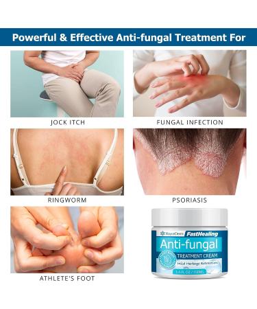 Roycederm Antifungal Cream - Maximum Strength Treatment for Athletes Foot, Eczema, Psoriasis, Jock Itch, Rash, Ringworm & Skin Yeast Infection - Buy Online on GoSupps.com
