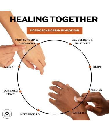 Motivo Scar Care Bundle - Scar Tape & Cream (15ml) | Water & Sweat Resistant, Ideal for Surgical, C-Section, Trauma & Acne Scars | Suitable for All Skin Types | Tan - Buy Online on GoSupps.com