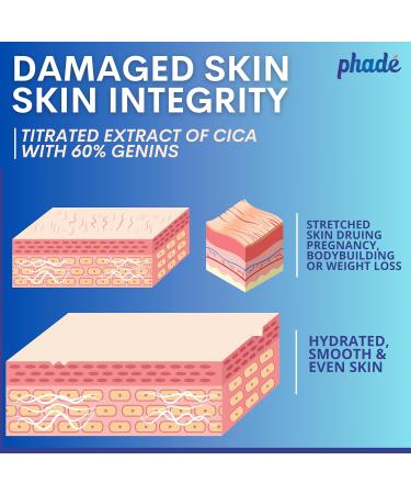 Phade Stretch Mark Cream with CICA - 200ml | Target Scars Uneven Skin Tone & Aging | Dermatologist Approved Clinically Proven for Hydration & Skin Repair - Buy Online on GoSupps.com