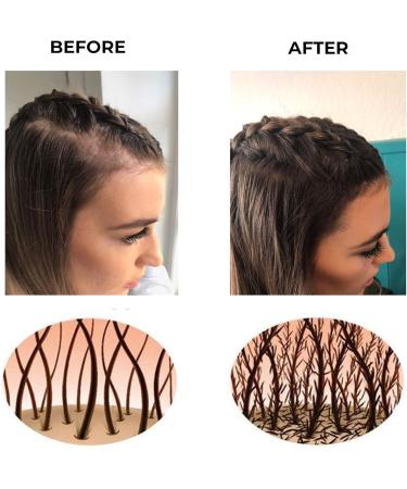 Coloured Hair Thickening Fibres by Keratech Pro 12ml | Instantly Fuller and Thicker hair | Advanced 100% Natural Keratin formula | Light Blonde - Buy Online on GoSupps.com