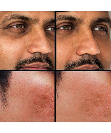KODE Mens Concealer Shade 2 - Dark Circle Under Eye Cream Corrector for Pimples, Scars, Rashes | Multi-Use Formula - Buy Online on GoSupps.com