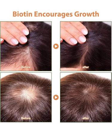 Batana Oil for Hair Growth Hair Growth Oil Organic Prevent Hair Loss Eliminates Split Ends Increases Shine Repairs Damaged Hair & Skin Promotes Hair thickness & Healthiness - Buy Online on GoSupps.com