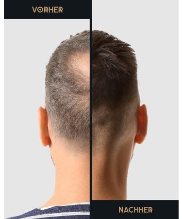 JP Confidence - Premium Hair Extensions | Full Hair in Seconds | Hair Thickening for Bald Spots (Light Brown) - Buy Online on GoSupps.com