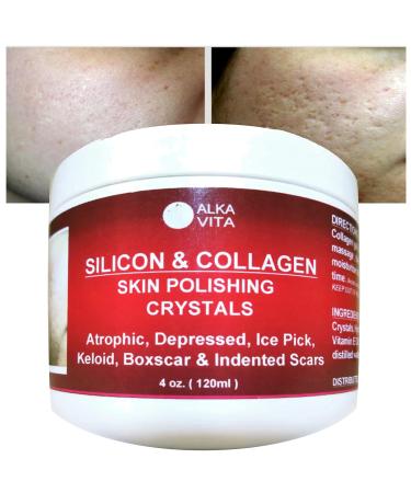 Alka Vita Acne Scars Silicon & Collagen Skin Polishing Crystals Gel For Indented Rolling Atrophic & Keloid Scars Natural Ingredients By  Clear  4.0 Fl Oz  (Pack of 1)