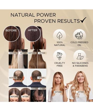 Prima Qualitas Raw Batana Oil for Hair Growth Enriched with 8 Powerful Oils Advanced Formula for Thicker Stronger Hair Repairs Dry Damaged Hair Prevents Hair Loss 100ml - Buy Online on GoSupps.com