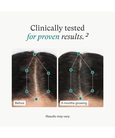 Nutrafol Women's Hair Growth Supplements - Clinically Proven Stronger Hair in 3-6 Months Dermatologist Recommended - 2 Month Supply & 2 Refill Pouches - Buy Online on GoSupps.com