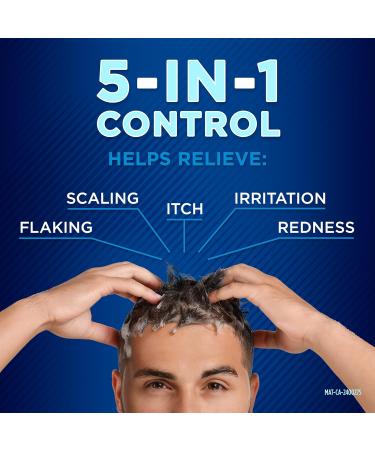 Selsun Blue Itchy Dry Scalp Anti-Dandruff Shampoo 300 mL Clean Fresh Scent For Itchy Dry Flaky Scaly Scalp Associated with Dandruff & Seborrheic Dermatitis - Buy Online on GoSupps.com