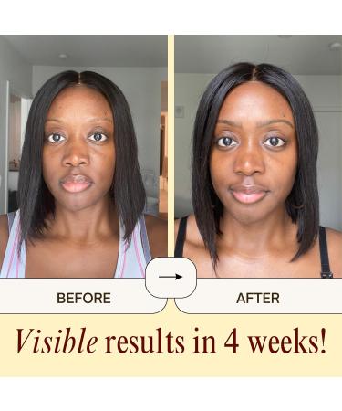 Barrier Support Dream Cream - Hydrating Moisturizer for Dry Sensitive Skin | Reduces Dark Marks & Evens Tone | Radiant Glowing Skin - International Shipping Available - Buy Online on GoSupps.com